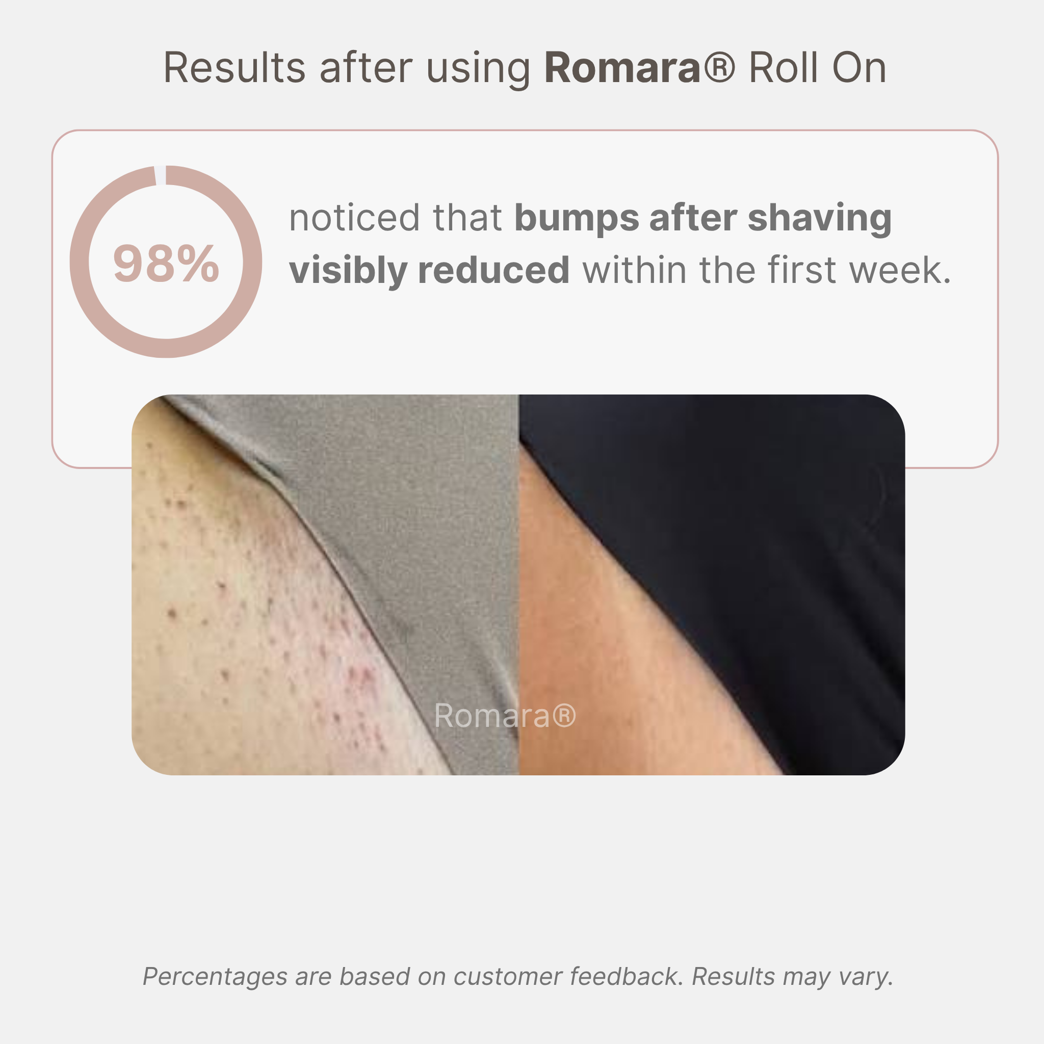 Romara® Roll-on for ingrown hairs and bumps