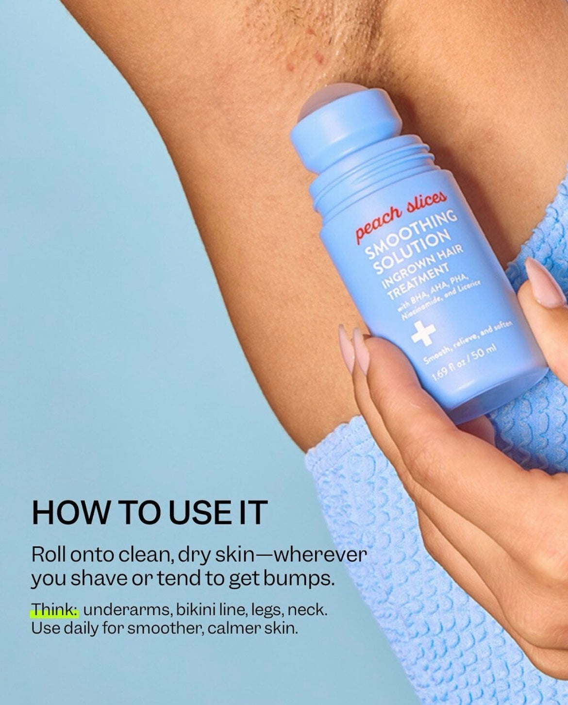 Romara® Roll-on for ingrown hairs and bumps