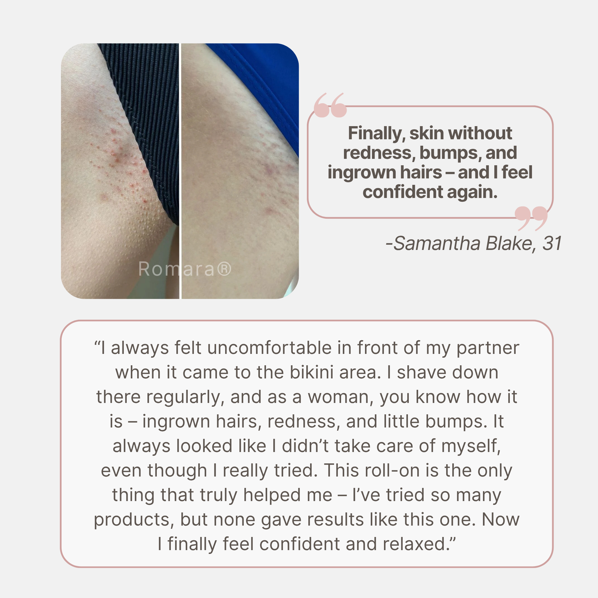 Romara® Roll-on for ingrown hairs and bumps